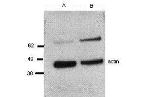 Image no. 1 for anti-Perforin 1 (Pore Forming Protein) (PRF1) antibody (ABIN477313) (Perforin 1 Antikörper)