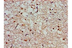 Immunohistochemistry of paraffin-embedded human brain tissue using ABIN7146350 at dilution of 1:100 (SLC25A12 Antikörper  (AA 202-317))