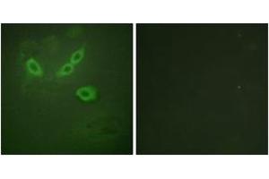 Immunofluorescence analysis of HeLa cells, using TUSC5 Antibody.