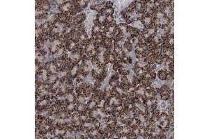Immunohistochemical staining of human pancreas with C6orf120 polyclonal antibody  shows strong cytoplasmic positivity in granular pattern in exocrine pancreas.