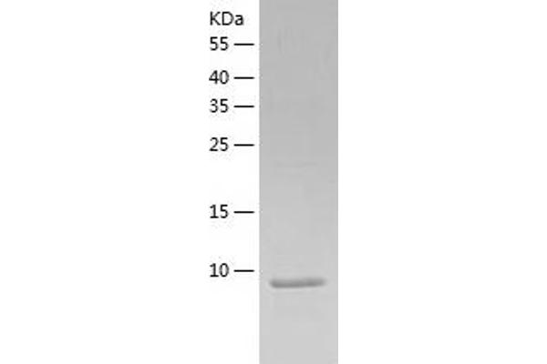 XCL1 Protein (AA 22-114) (His tag)