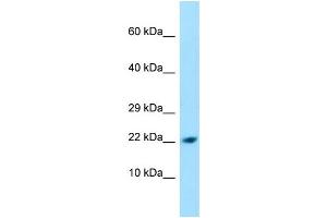 WB Suggested Anti-PPIL1 Antibody Titration: 1. (PPIL1 Antikörper  (N-Term))