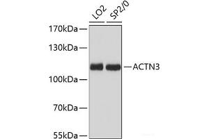 Western blot analysis of extracts of various cell lines using ACTN3 Polyclonal Antibody at dilution of 1:3000. (ACTN3 Antikörper)
