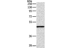Western blot analysis of Mouse fat tissue, using INHBA Polyclonal Antibody at dilution of 1:1000