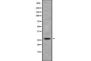 Western blot analysis of C/EBP δ/ε using LOVO whole cell lysates (C/EBP delta/epsilon Antikörper)