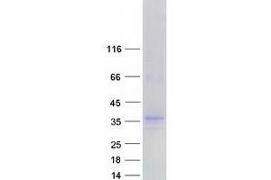Western Blotting (WB) image for Synaptoporin (SYNPR) (Transcript Variant 1) protein (Myc-DYKDDDDK Tag) (ABIN2733064)