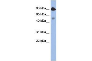 WB Suggested Anti-BCL2L13  Antibody Titration: 0. (BCL2L13 Antikörper  (Middle Region))