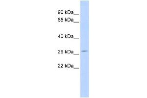WB Suggested Anti-SCOTIN Antibody Titration:  0. (SHISA5 Antikörper  (Middle Region))