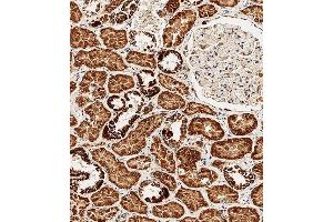 Immunohistochemical analysis of paraffin-embedded Human kidney tissue using (ABIN654629 and ABIN2844325) performed on the Leica® BOND RXm.
