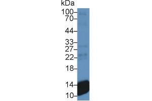 Western Blot; Sample: Human Platelet lysate; Primary Ab: 300 Mouse Anti-Human bTG Antibody Second Ab: 0. (CXCL7 Antikörper  (AA 59-128))