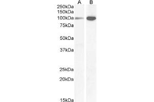 ABIN185678 (1µg/ml) staining of Human Amylgada (A) and Rat (B) Brain lysate (35µg protein in RIPA buffer). (GRIN1/NMDAR1 Antikörper  (Internal Region))
