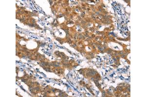 Immunohistochemistry (IHC) image for anti-Cylindromatosis (Turban Tumor Syndrome) (CYLD) antibody (ABIN2432904) (CYLD Antikörper)