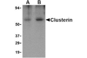 Image no. 1 for anti-Clusterin (CLU) (Isoform 1) antibody (ABIN265125) (Clusterin Antikörper  (Isoform 1))