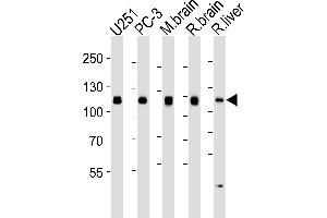Western blot analysis of lysates from , PC-3 cell line, mouse brain, rat brain and liver tissue lysates (from left to right), using USP5 Antibody (ABIN1944895 and ABIN2838537). (USP5 Antikörper)