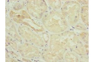 Immunohistochemistry of paraffin-embedded human kidney tissue using ABIN7154838 at dilution of 1:100 (NYS48/HAUS8 Antikörper  (AA 166-410))