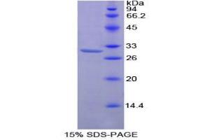 SDS-PAGE analysis of Mouse Protein Kinase C zeta Protein. (PKC zeta Protein)