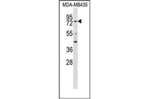 Western blot analysisof RFX3 Antibody (C-term) in MDA-MB435 cell line lysates (35ug/lane). (RFX3 Antikörper  (C-Term))