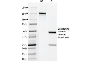 SDS-PAGE Analysis Purified hCG Mouse Monoclonal Antibody (HCGab/52). (CGA (HCG-Alpha) & CGB (HCG-Beta) Antikörper)