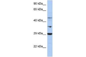 PDK3 antibody used at 1 ug/ml to detect target protein. (PDK3 Antikörper  (Middle Region))