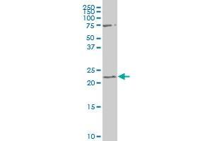 RGS19 polyclonal antibody (A02), Lot # 050926JC01. (RGS19 Antikörper  (AA 51-140))