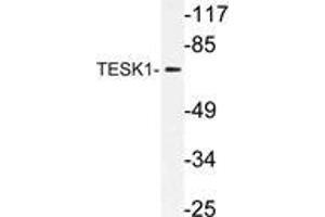 Western blot (WB) analysis of TESK1 antibody in extracts from rat liver cells.