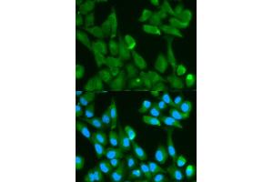 Immunofluorescence analysis of HeLa cell using FABP4 antibody. (FABP4 Antikörper)