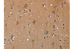 The image on the left is immunohistochemistry of paraffin-embedded Human brain tissue using ABIN7191717(NRG3 Antibody) at dilution 1/30, on the right is treated with synthetic peptide. (Neuregulin 3 Antikörper)