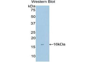 Western Blotting (WB) image for anti-Matrix Gla Protein (MGP) (AA 1-103) antibody (ABIN1859811)