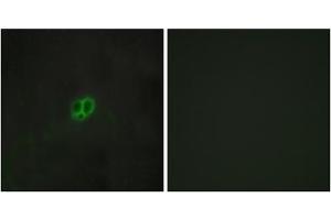 Immunofluorescence analysis of MCF-7 cells, using CRHR1 antibody. (CRHR1 Antikörper  (Internal Region))