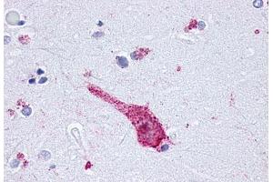 Anti-OPRM1 / Mu Opioid Receptor antibody  ABIN1049171 IHC staining of human brain, neuron. (Mu Opioid Receptor 1 Antikörper  (C-Term))