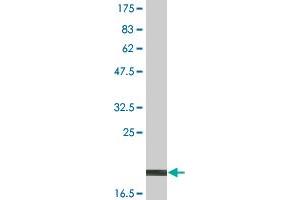 Western Blotting (WB) image for anti-Lymphotoxin-alpha (LTA) (AA 58-205) antibody (DYKDDDDK Tag,His tag) (ABIN2752662)