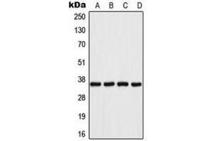 Western blot analysis of Aldose Reductase expression in Jurkat (A), HeLa (B), SP2/0 (C), PC12 (D) whole cell lysates. (AKR1B1 Antikörper  (C-Term))
