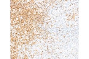 Immunohistochemistry (IHC) image for anti-CD247 Molecule (CD247) (C-Term) antibody (ABIN7455240) (Rekombinanter CD247 Antikörper  (C-Term))