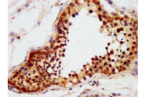 IHC image of ABIN7151284 diluted at 1:600 and staining in paraffin-embedded human testis tissue performed on a Leica BondTM system. (TRIM71 Antikörper  (AA 125-209))