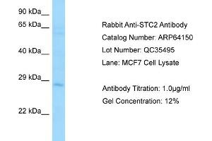 Western Blotting (WB) image for anti-Stanniocalcin 2 (STC2) (C-Term) antibody (ABIN2789749)