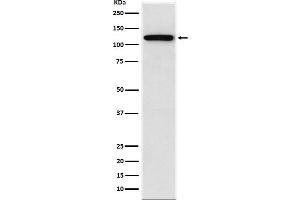 Western blot analysis of Sortilin expression in SW480 cell lysate. (Rekombinanter Sortilin 1 Antikörper)