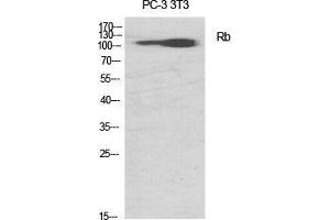 Western Blot (WB) analysis of specific cells using Rb Polyclonal Antibody. (Retinoblastoma 1 Antikörper  (Thr676))