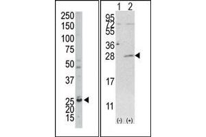 Image no. 1 for anti-Adenylate Kinase 4 (AK4) (C-Term) antibody (ABIN360619) (AK4 Antikörper  (C-Term))