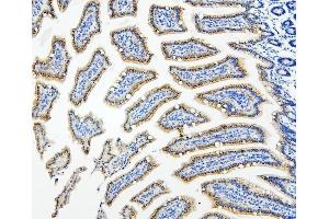 IHC analysis of HDAC5 using anti-HDAC5 antibody (ABIN7599922). (HDAC5 Antikörper  (AA 13-1107))