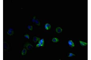 Immunofluorescent analysis of MCF-7 cells using ABIN7173107 at dilution of 1:100 and Alexa Fluor 488-congugated AffiniPure Goat Anti-Rabbit IgG(H+L) (TMEM184B Antikörper  (AA 311-407))