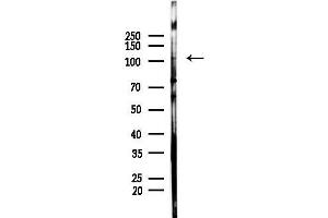 anti-Inositol Polyphosphate-5-Phosphatase, 145kDa (INPP5D) (C-Term) antibody