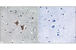 Immunohistochemistry analysis of paraffin-embedded human brain, using WASF4 Antibody. (WASF4 Antikörper  (AA 190-239))