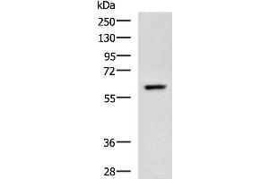 Western blot analysis of A549 cell lysate using TERF1 Polyclonal Antibody at dilution of 1:400 (TRF1 Antikörper)