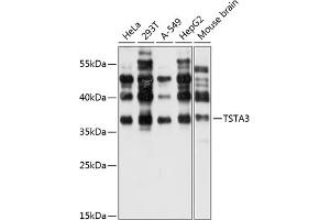 Western blot analysis of extracts of various cell lines, using TST antibody (ABIN6127523, ABIN6149663, ABIN6149664 and ABIN6220526) at 1:1000 dilution. (TSTA3 Antikörper  (AA 1-321))