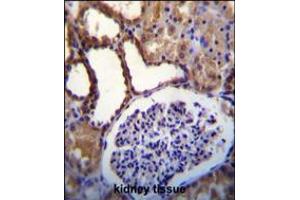 WNK3(PRKWNK3) Antibody immunohistochemistry analysis in formalin fixed and paraffin embedded human kidney tissue followed by peroxidase conjugation of the secondary antibody and DAB staining. (WNK3 Antikörper  (C-Term))