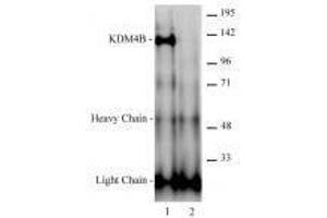 JMJD2B / KDM4B antibody (rAb) tested antibody tested by immunoprecipitation. (Rekombinanter KDM4B Antikörper)