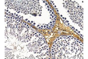 ABIN6260161 and ABIN6279063 at 1/100 staining rat testis tissue by IHC-P. (AWAT2 Antikörper  (Internal Region))