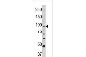 Western blot analysis of anti-CPT1A Pab in Y79 cell line lysate (35ug/lane). (CPT1A Antikörper  (C-Term))