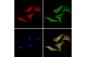 ABIN6258945 and ABIN6275115 staining Hela cells by IF/ICC.