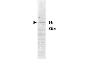 Western blot using POLK polyclonal antibody  shows detection ofa band ~98 KDa corresponding to human POLK (arrowhead). (POLK Antikörper  (AA 817-830))